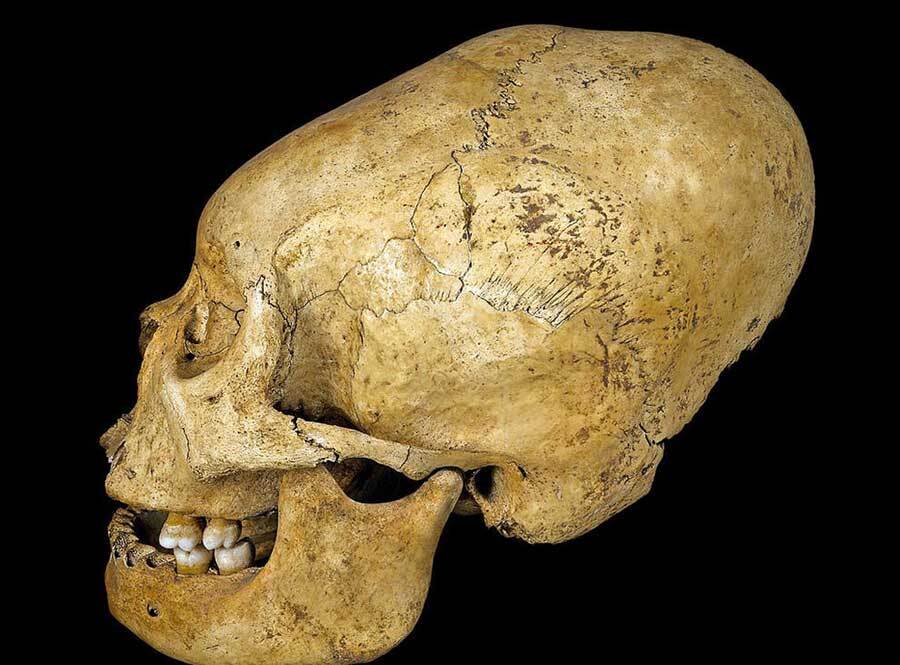 peru elongated skull