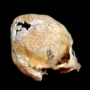National Museum of Archaeology, Anthropology and History, Lima - Human Remains National Museum of Archaeology, Anthropology and History, Lima - Human Remains